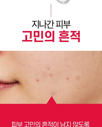 [PAUL MEDISON] Deep red+ Spot Remover 25ml /韓国化粧品 にきび肌 肌トラブル - コクモト KOCUMOTO